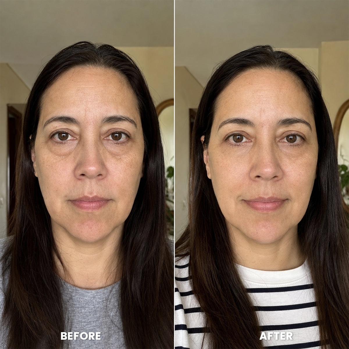 Before and after morning puffiness