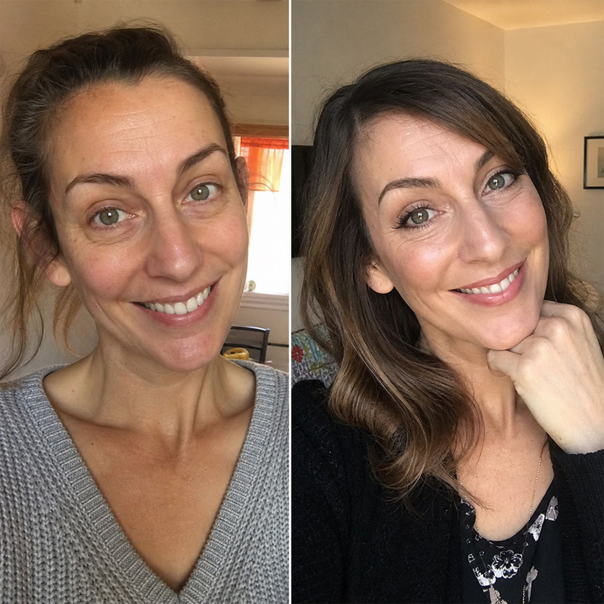 derma_before_after_1_34186ca1-0ea9-42e9-bf1b-2ab696c719e1-660344f72c5a.jpg